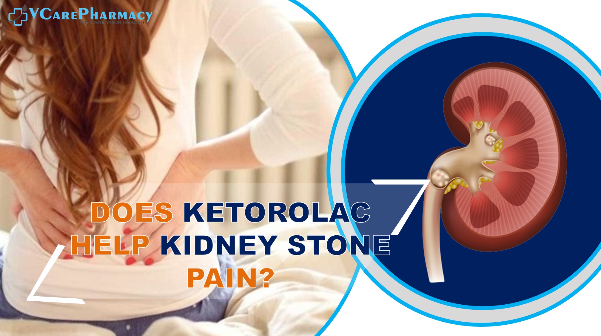 Does Ketorolac (Toradol) help kidney stone pain?