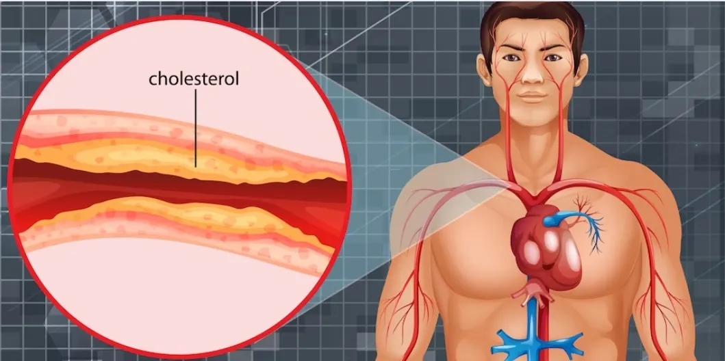 Simvastatin 40 mg Pills: The Best Way to Control Cholesterol Levels